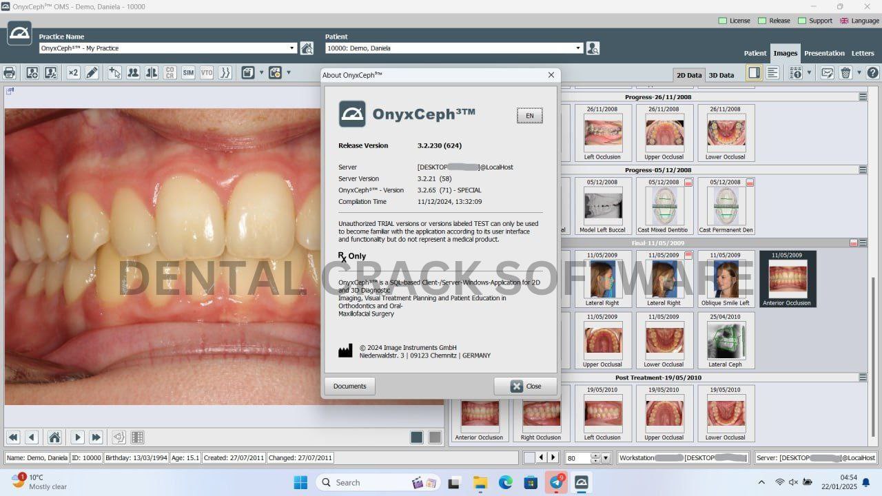 OnyxCeph³™ 3.2.230 (Permanent Activation)