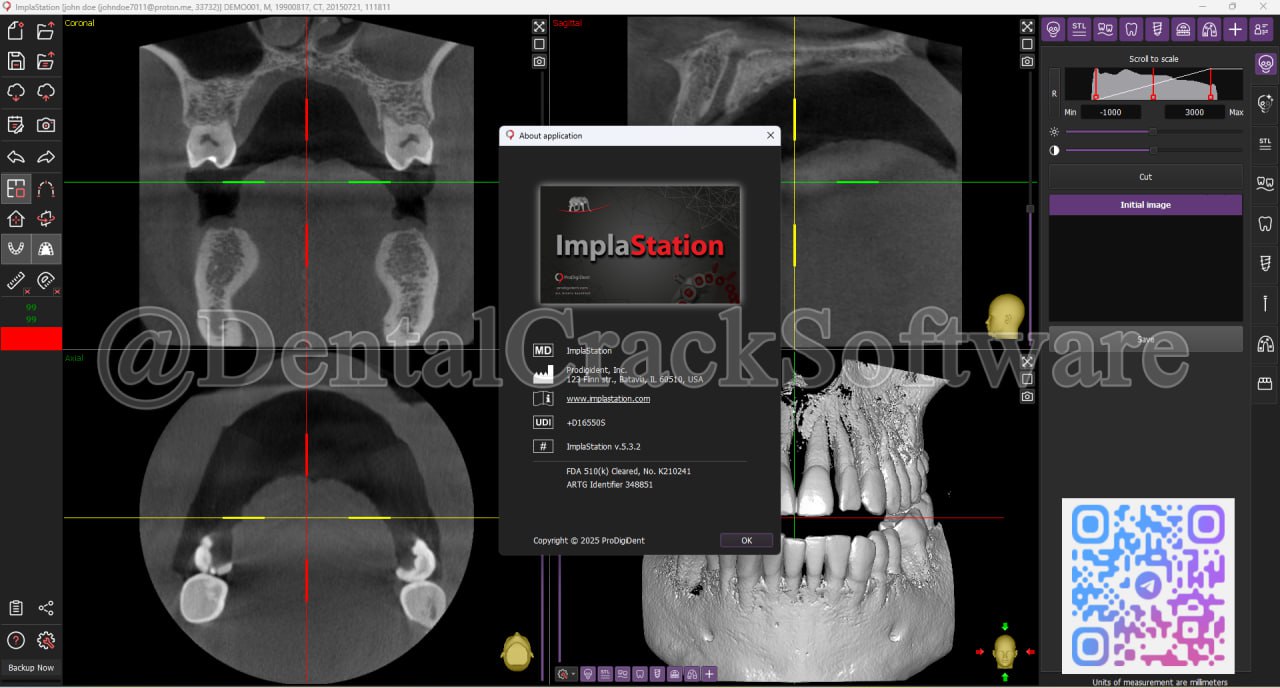 ImplaStation v5.3.2 Surgical Planning Workspace