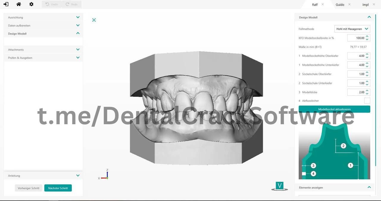 SHERAeasy-model Dental Model Builder Screen